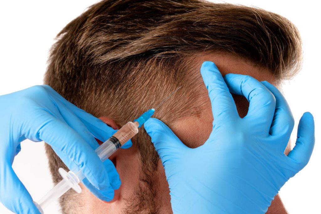 PRP Hair Loss Treatments